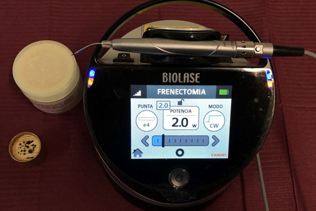 Láser aplicado en ATM y dolor cráneo cervical facial