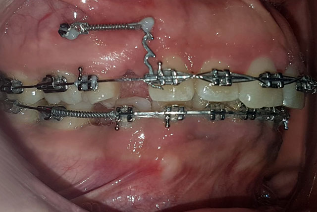 DIPLOMATURA en Ortodoncia y Ortopedia Dentomaxilofacial