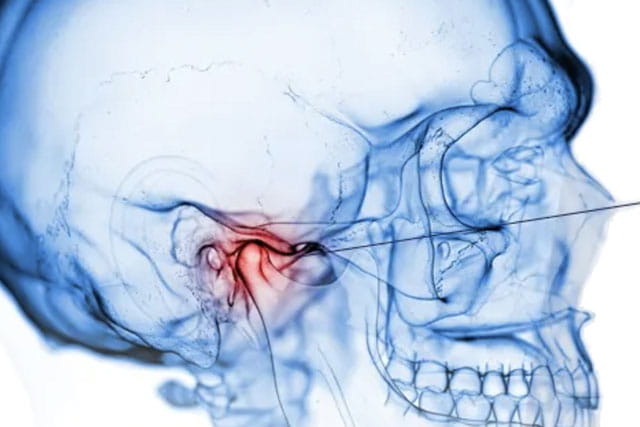 Abordaje integral Fono-Odontológico: Alteraciones Funcionales y Estructurales. “La Terapia Miofuncional…”