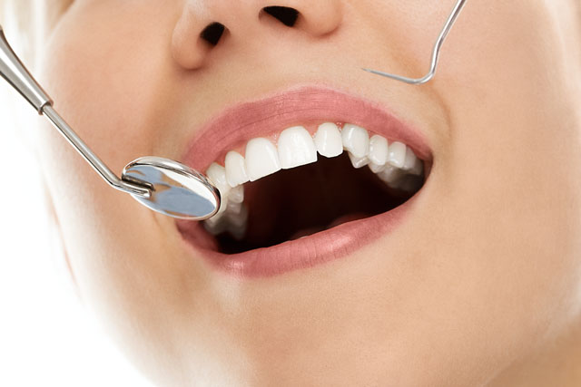Restauraciones Post Endodoncia