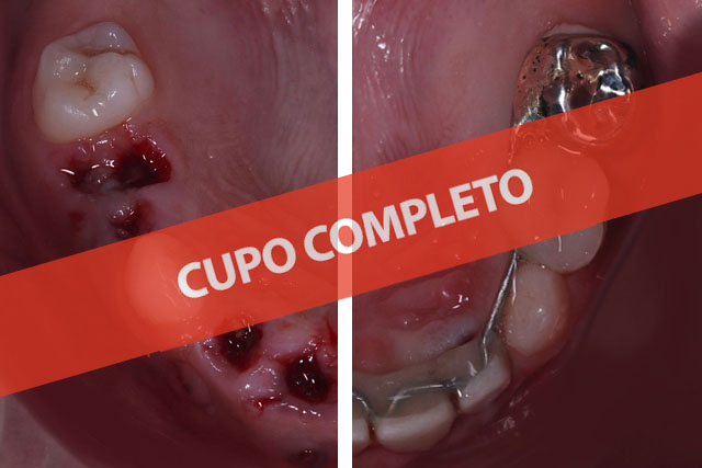 Aparatología infantil, un nexo entre la salud y la Estética