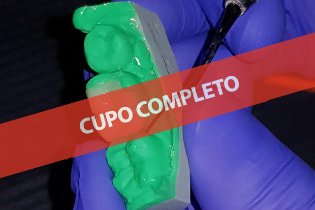 Incrustaciones: desde el Diagnóstico al Cementado