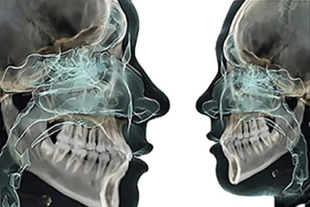 Nivelación en Imágenes Digitales en Odontología