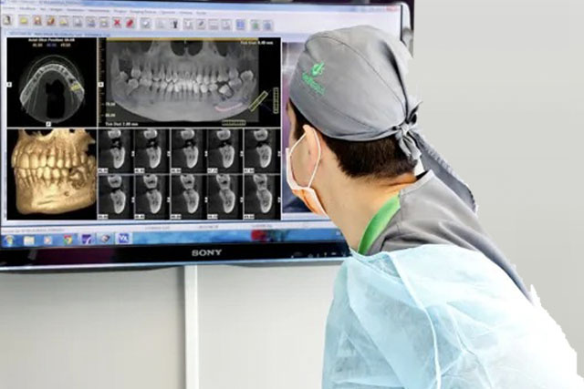 Planificación Quirúrgica Digital en Implantología Oral