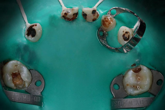 CoronHadas 2: Posteriores