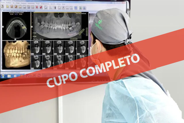 Planificación Quirúrgica Digital en Implantología Oral