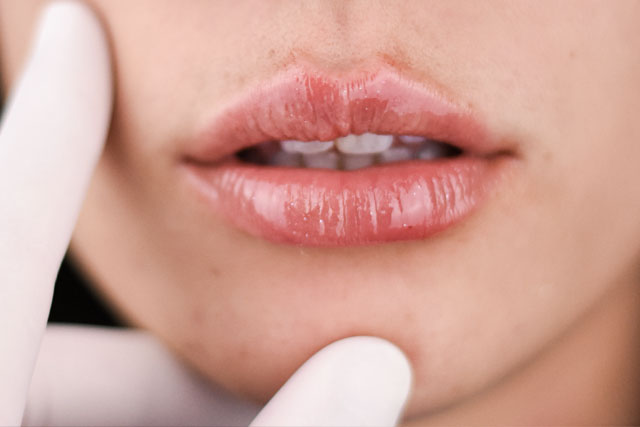 Armonización Facial 360°: Abordaje integral multidisciplinario