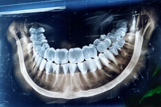 Diagnóstico por imágenes en el paciente pediátrico: lo que todo odontólogo necesita saber