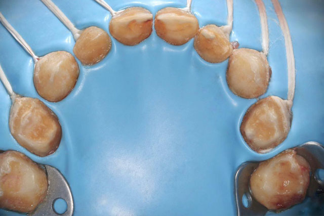 Aparatología infantil, un nexo entre la salud y la Estética
