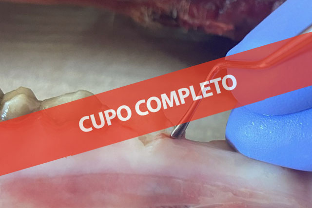 Manejo de tejidos blandos y reconstrucción gingival en dientes e implantes – FULL DAY HANDS-ON [Nueva edición]
