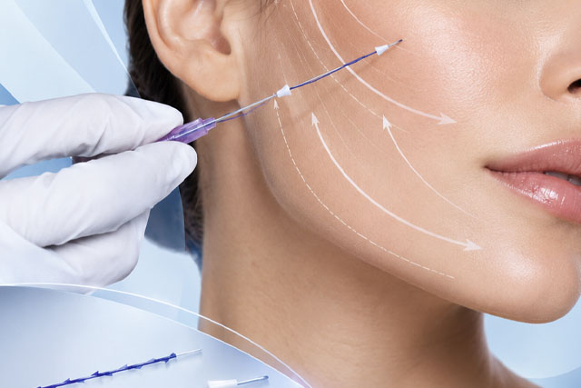 Hilos, Lipolisis y complicaciones en la armonización orofacial